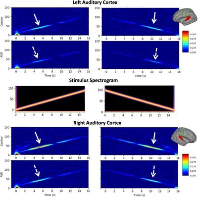 Magnetoencephalography Studies of the Envelope Following Response During Amplitude-Modulated Sweeps: Diminished Phase Synchrony in Autism Spectrum Disorder